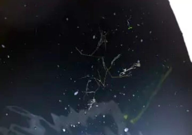 रिम्स की टंकियों में जमा गंदा पानी बना बीमारी का टैंक