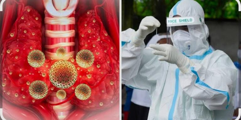 तीन दिन में 17 नए केस, एक्टिव मरीजों की संख्या हुई 21, स्वास्थ्य विभाग अलर्ट मोड में 