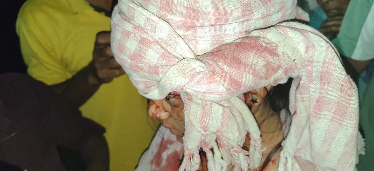 SIR कार्य कर लौट रहे लोग सड़क हादसे का शिकार, एक की मौत